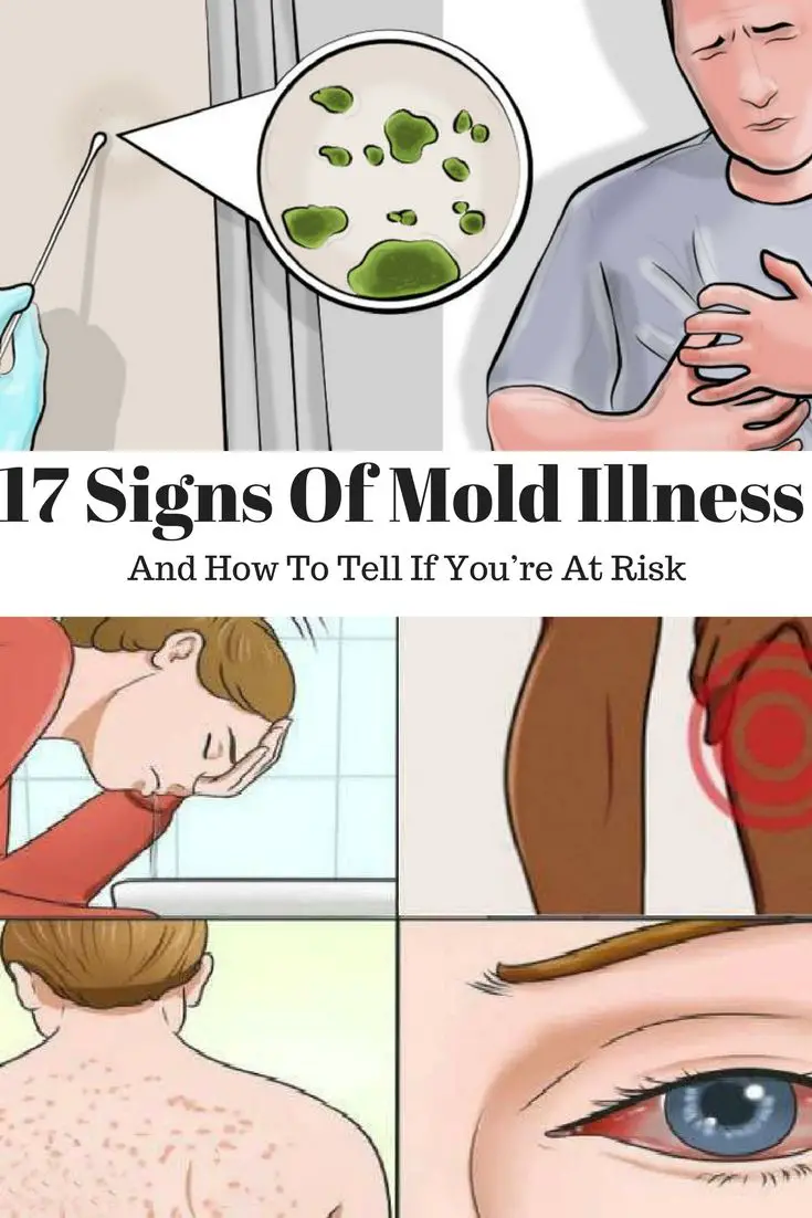 17 Signs Of Mold Illness (And How To Tell If Youâre At ...