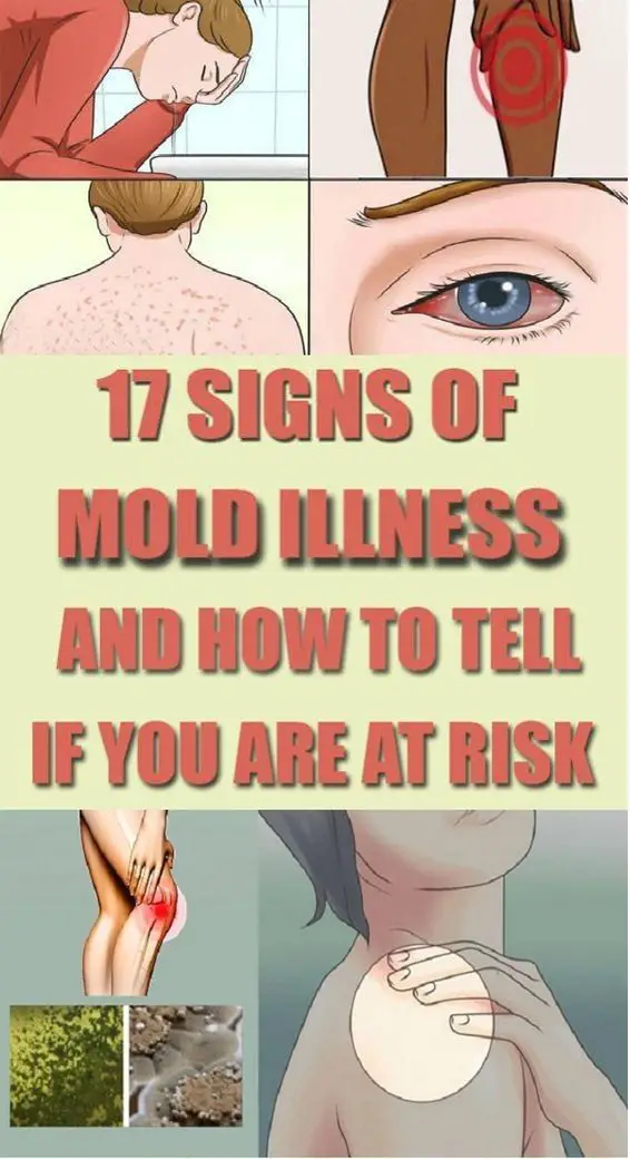 17 Signs Of Mold Illness Telling You Are In Risk !