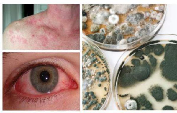 21 Early Warning Signs Of Mold Toxicity and How to Get Rid ...