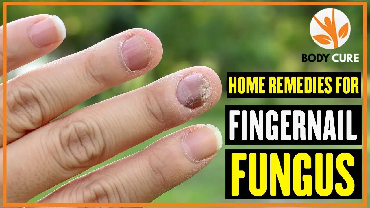 5 Home Remedies For Fingernail Fungus