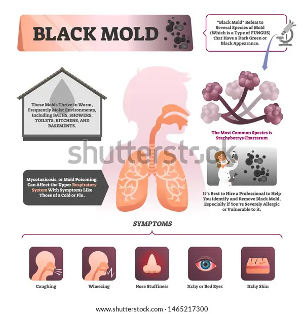 Black Mold Vector Illustration Labeled Symptoms Stock Vector (Royalty ...