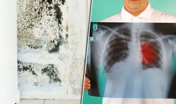 Could your house be giving you lung disease? Condition ...