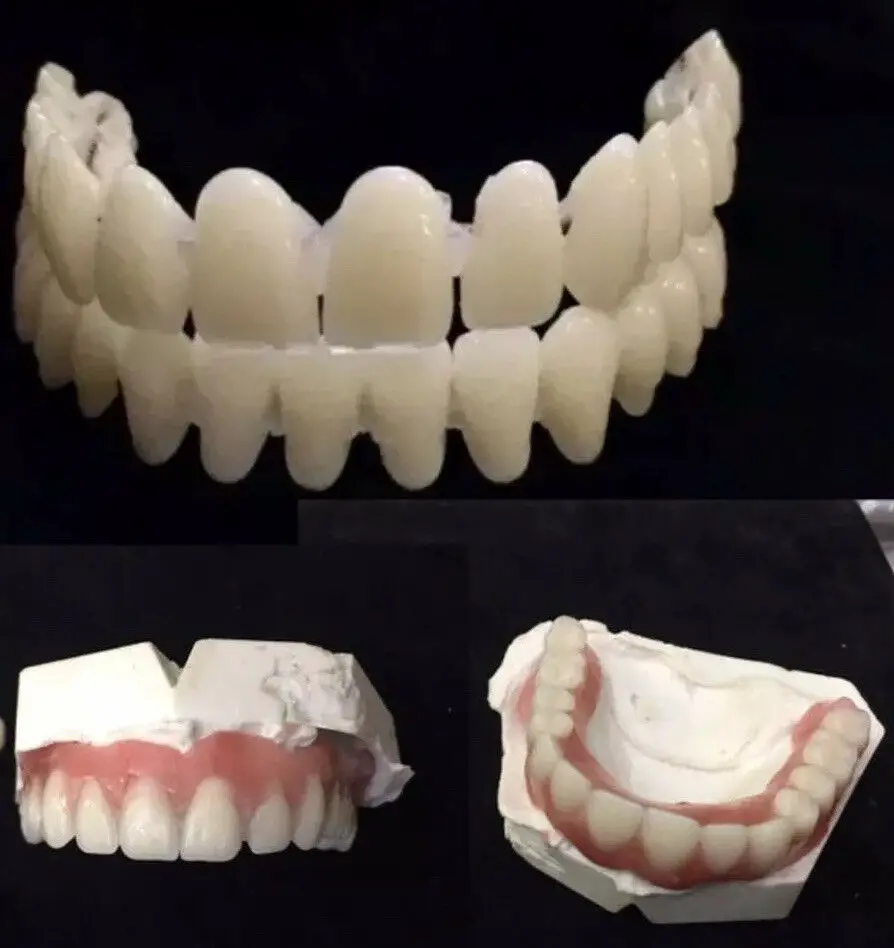 DIY Denture Kit A2 Dental Impression Putty Cast Mold Upper/Lower Non ...