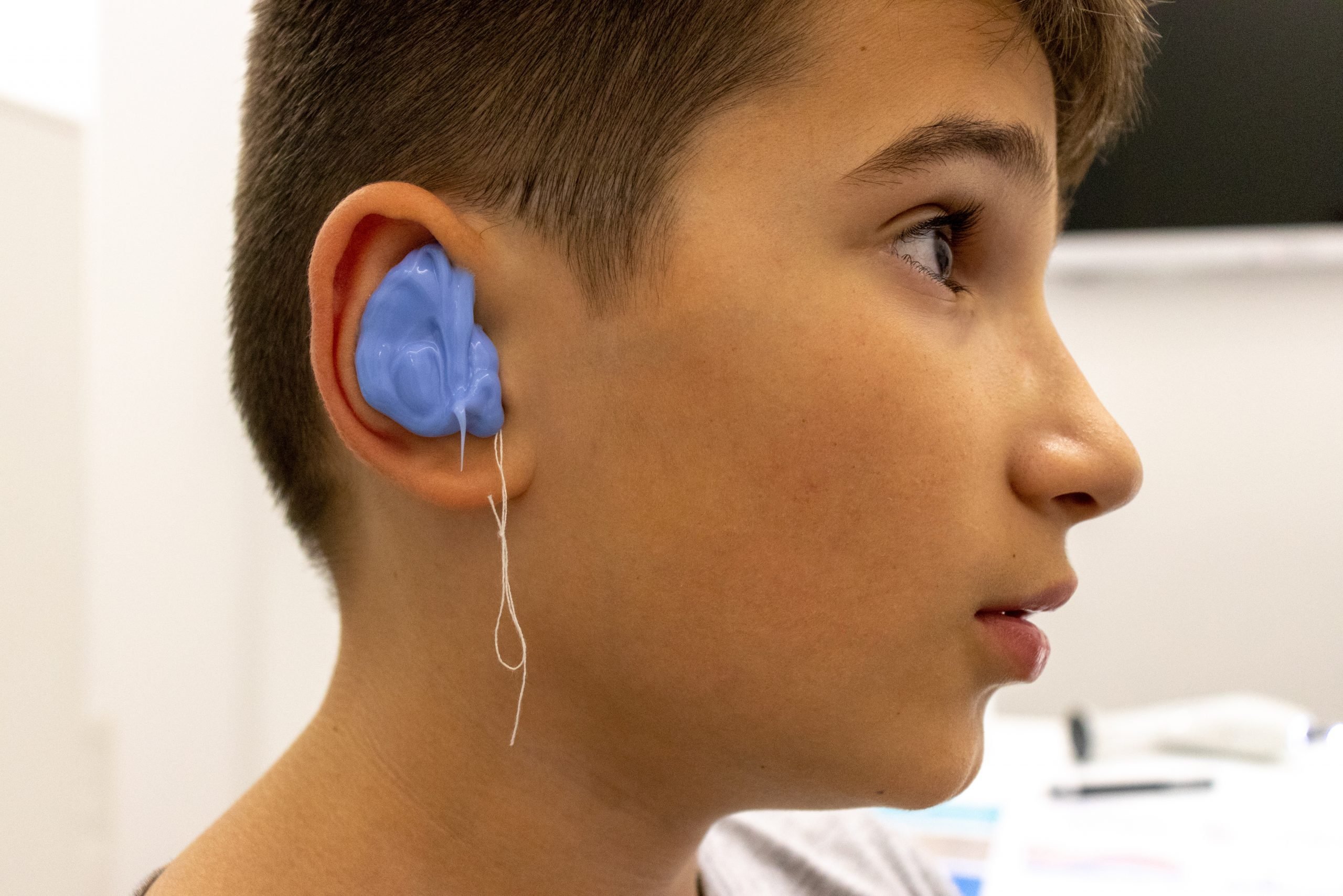 Hearing Aids &  Custom Ear Plugs