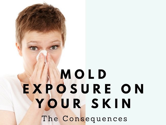Mold Exposure on Your Skin  The Consequences