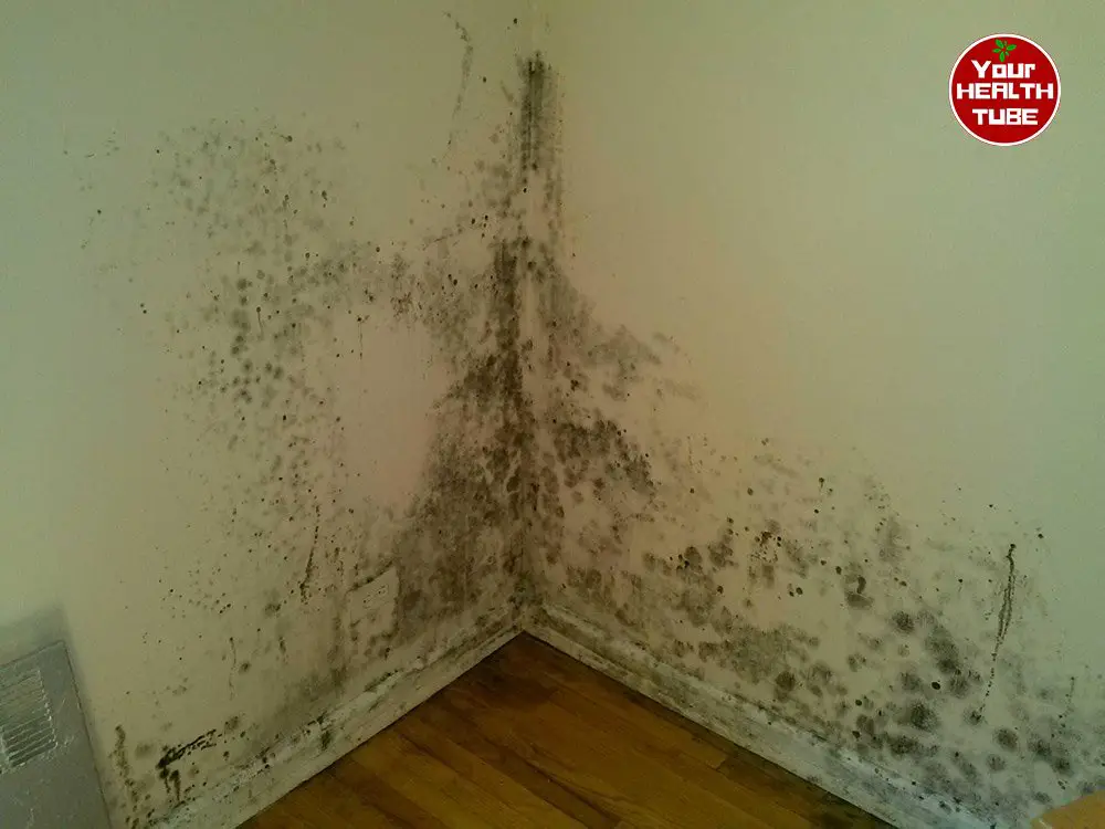 Mold Health Issues: How to Get Rid of Damp and Mold?