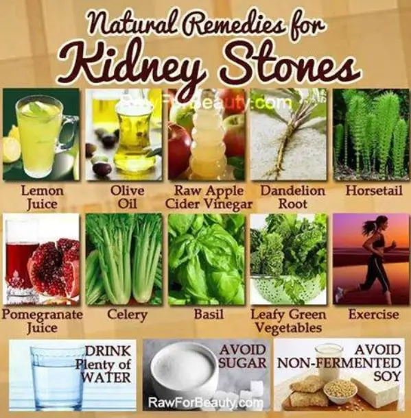 Natural Remedies for Kidney Stones Follow us @ http://pinterest.com ...