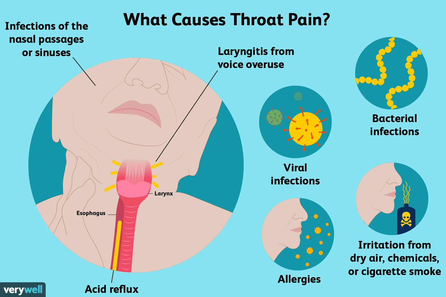 Throat Pain: Causes, Treatment and When to See a Doctor